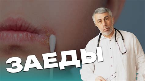 th?q=как+вылечить+заеды+за+один+день+отзывы+мазь+от+заедов+в+уголках+рта+для+взрослых