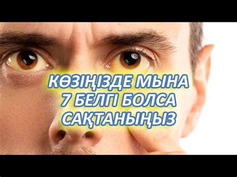 th?q=көз+қызарып+ауырса+көз+давлениесі+белгілері