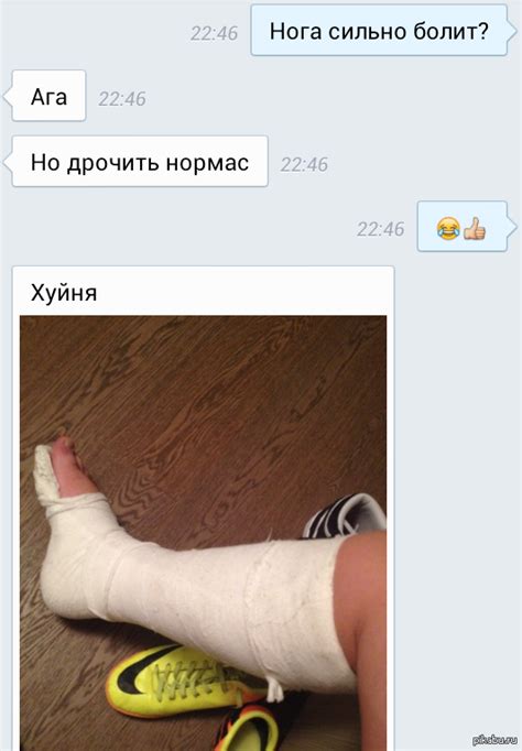 th?q=к+чему+снится+что+друг+сломал+ногу