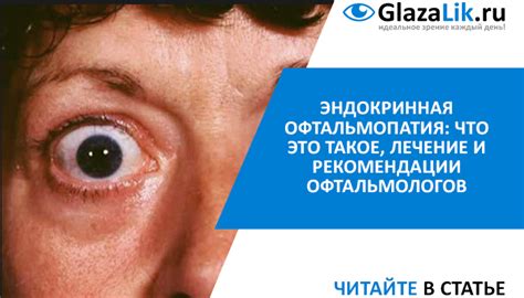 th?q=лечение эндокринной офтальмопатии новосибирск