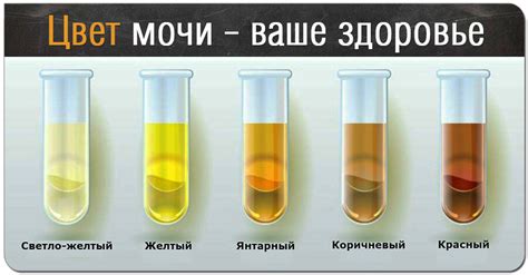 th?q=моча+снилась+упала+в+мочу