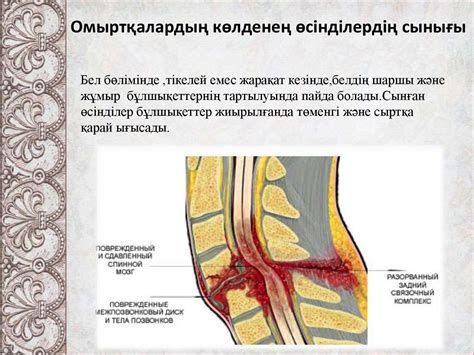 th?q=омыртқа+зақымдануы+презентация