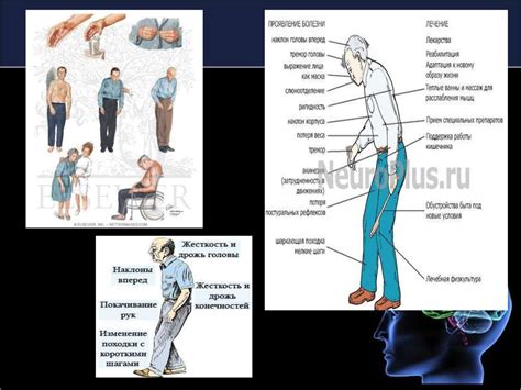 th?q=паркинсон+ауруы+емі+паркинсон+ауруы+презентация