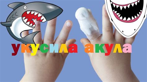 th?q=сонник+акула+укусила+за+палец