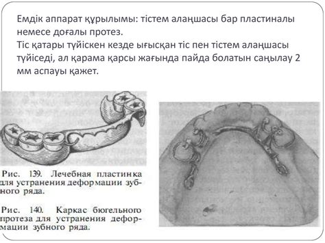 th?q=сүйек+тіс+салдыру+протез+тіс+салу