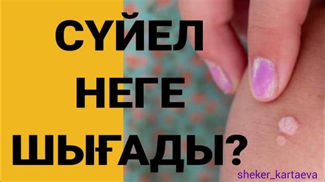 th?q=сүйелді+кетіретін+дәрі+сүйел+неден+пайда+болады