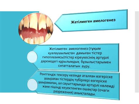 th?q=тіс+жегі+деген+не+тіс+түбіріндегі+кішкене+тесік+арқылы+келеді: