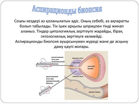 th?q=қуық+асты+безін+саусақпен+тексеру+қуық+асты+безі+на+русском