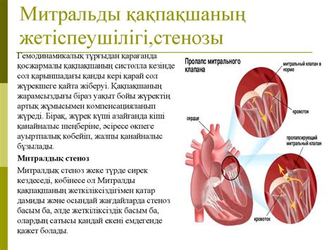 th?q=үш+жақтаулы+қақпақша+балалардағы+жүре+пайда+болған+жүрек+ақаулары