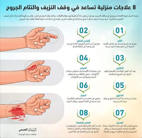 كيفية التعامل مع الجروح