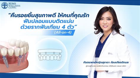 ยิ้มสว่างสดใสกับฟัน 888: ปลดล็อกรอยยิ้มที่สมบูรณ์แบบของคุณ!