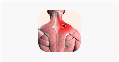 ‎Trigger point - Body im App Store