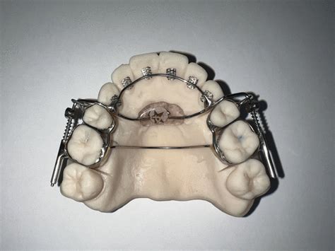 ‘AGGA’ inventor testifies his dental device was not meant for TMJ or sleep apnea