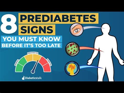 ‘Get yourself checked out’: Knowing the signs of prediabetes before it’s too late