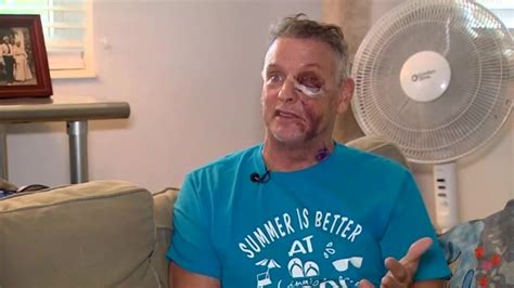 ‘God left me there for a reason’: Coconut Grove man home from hospital amid recovery from street beating