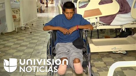 “No sean tontos”: hispano sufre la amputación de ambas piernas por la diabetes