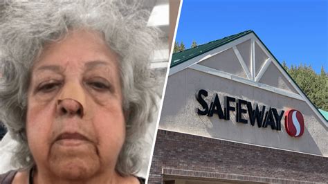 “Pensé que me iba a matar”: mujer sobrevive brutal ataque en Safeway en DC