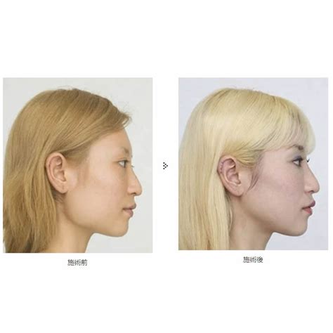 エラ骨削り 公式 静岡中央クリニック 医療レーザー脱毛から外科手術まで幅広く対応