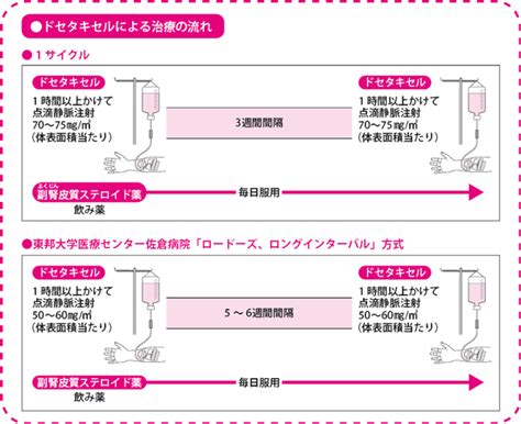 前立腺がんの「化学療法」治療の進め方は？治療後の経過は？