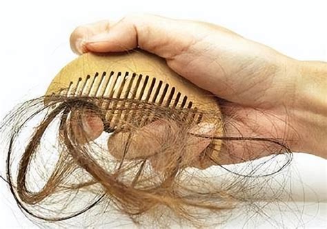 女人头发脱落是什么原因