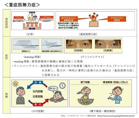 本日のご挨拶と第48回PTOT国家試験の解答解説 「国試塾リハビリアカデミー」中島塾長の …