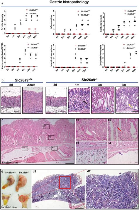 胃上皮内瘤变,gastric intraepithelial neoplasia英语短句,例句大全