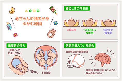 赤ちゃんの頭の形が気になったら？ 〜頭の変形は専門医へ〜 –