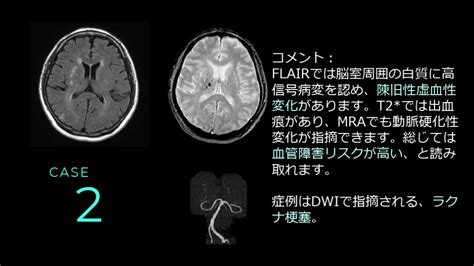 頭部MRIを自信を持ってプレゼンする7 Rules Antaa …