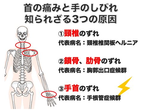 首の痛みと手のしびれ…病院は何科？原因と治し方も。 …