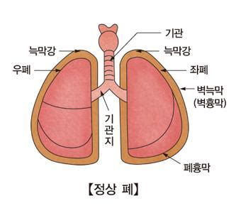 간대성근경련증 myoclonus 알기쉬운의학용어 서울아산병원
