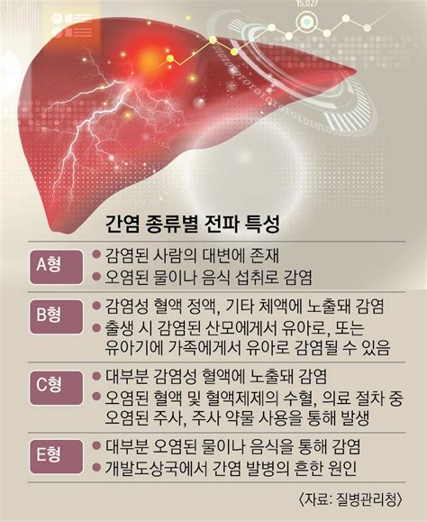 간염 원인 - 형 간염 질환백과 의료정보 건강정보 서울아산병원
