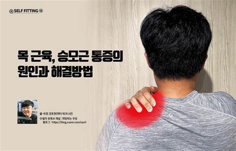견갑거근 tp - 두통과 목 어깨 등 통증의 원인 승모근! 방사통과 운동 방법
