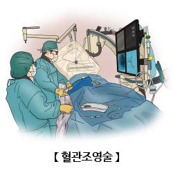 결장창냄술 검사/시술/수술정보 의료정보 건강정보 서울아산병원