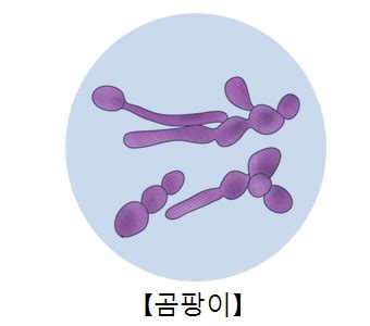 곰팡이 감염 질환백과 의료정보 건강정보 서울아산병원