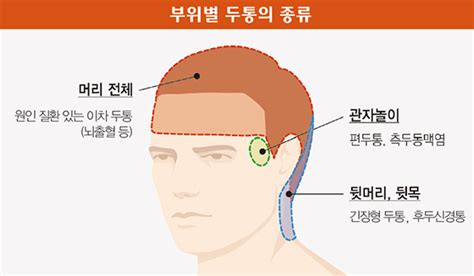 관자놀이 누르면 통증