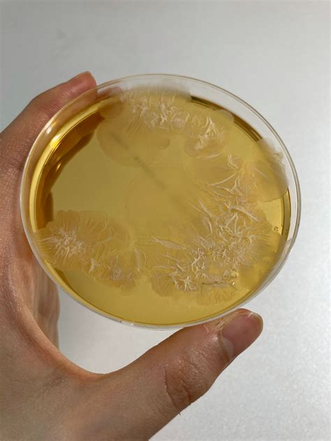 김치 유산균 배양 실험