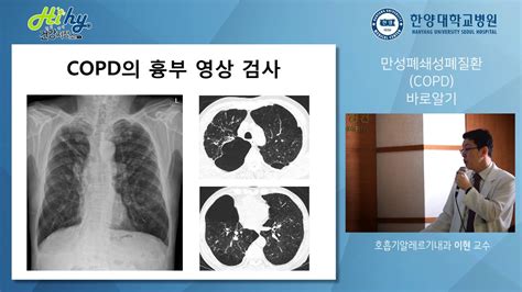 만성 폐쇄성 폐 질환 진단