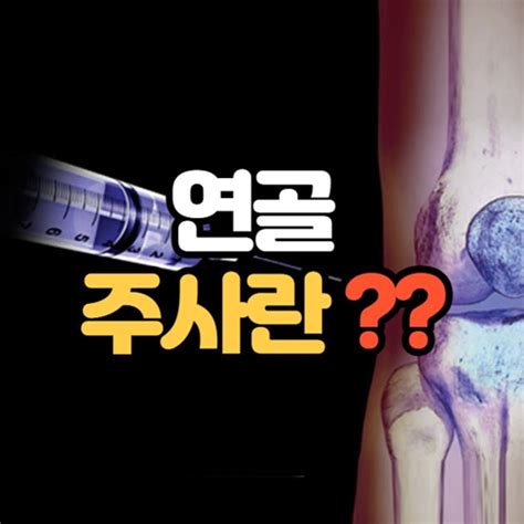 무릎 연골주사의 모든것 부작용,효과,가격,의료보험 정형외과