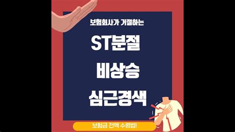 분절 비상승 심근경색, 증상 48시간 이내 시술해야 연합뉴스> ST분절