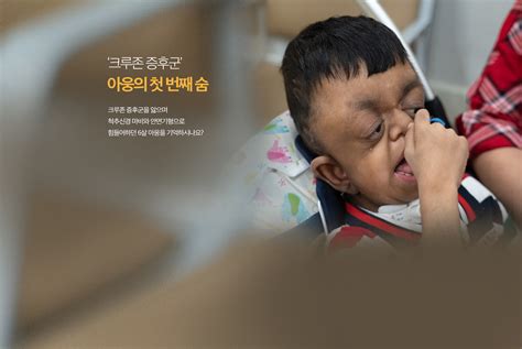 서울 크루존 증후군민석이에게 희망을!