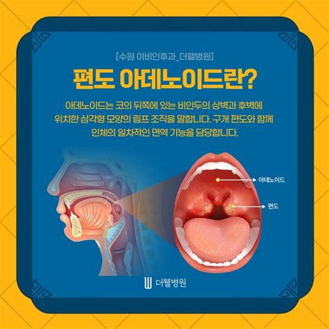 아데노이드 수술 총정리 절제/비대칭/가격/통증/팁