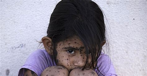 아르헨 점박이 소녀 의 비극, Gm 농작물 농약 오염 때문 다음