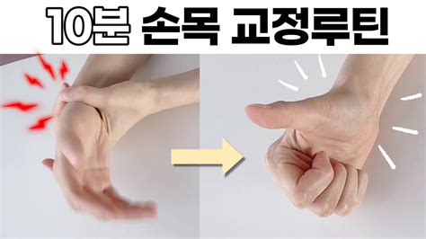엄지손가락 손목에 통증이 심하다면 손목건초염 의심해 보세요