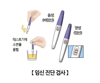 임신 진단 검사 검사/시술/수술 정보 의료정보 서울아산병원