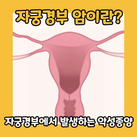 자궁경부암 Cervical Cancer 에 관한 모든 것 - 자궁 경부암 영어 로