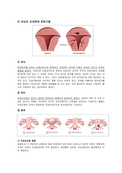 자궁 근종 간호 진단
