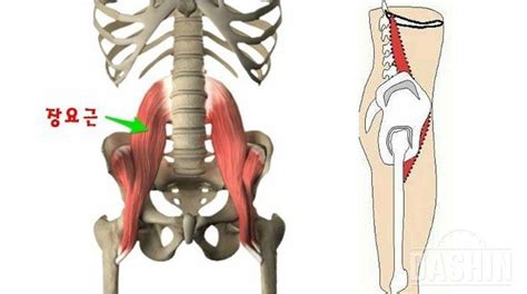 장요근/엉덩허리근의 구조와 임상적 의미