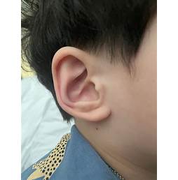 접힌 귀 관상 (Qy6Lg2V)