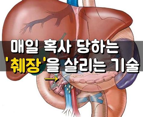 췌장 에 좋은 운동 - 췌장을 청소하고 활성화하는 방법