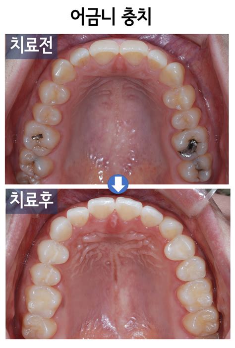 치과 보존 과 ew159t